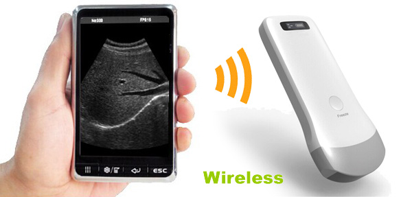 Ultrasound Hook Up To Phone
