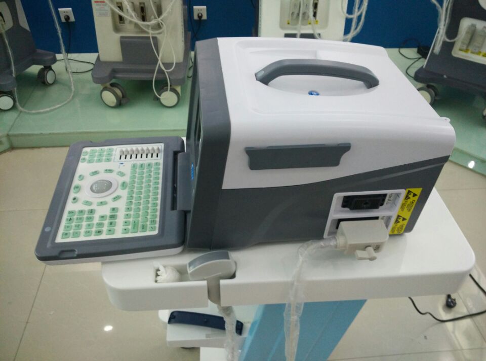 Hot Sale Cheap Medical 2D Portable Ultrasound Machine Price for