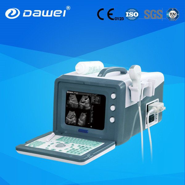 Hot Sale Cheap Medical 2D Portable Ultrasound Machine Price for