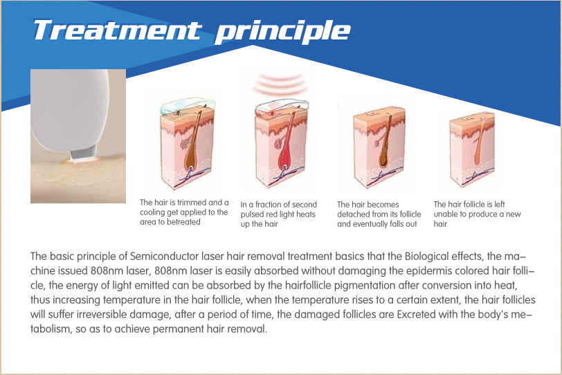 CE Approved Lazer Epilation 808 Nm Diode Laser purchasing ...