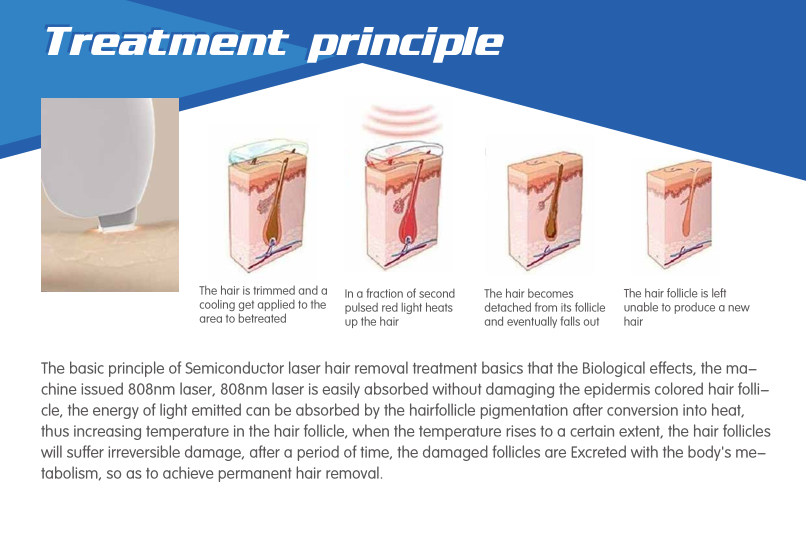 portable diode laser hair removal machine