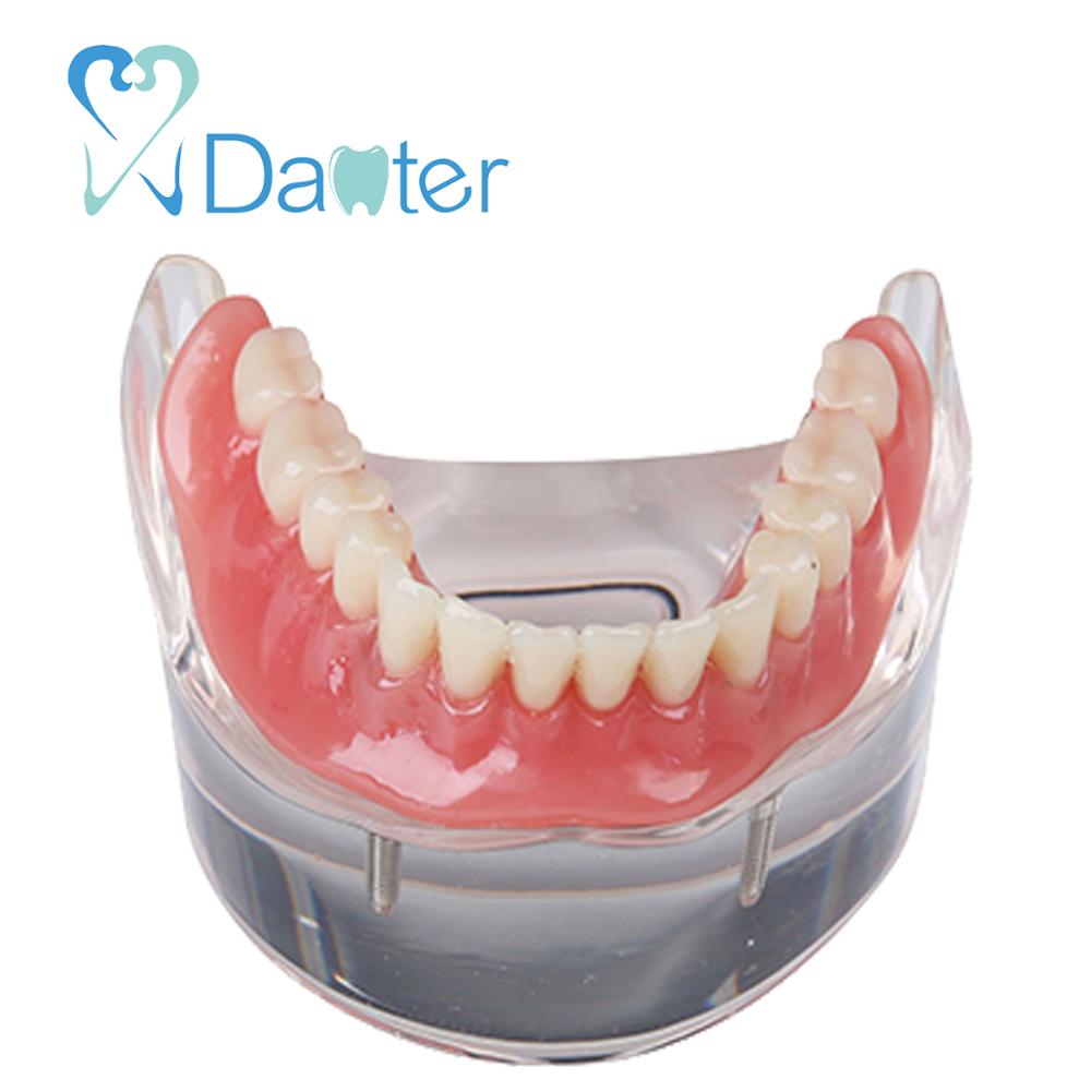 Danter 2 implants restoration sillones dental model implant dental tool for training