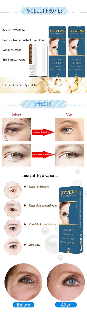 7 second miracles lifting anti wrinkle 6ml eye zone cream