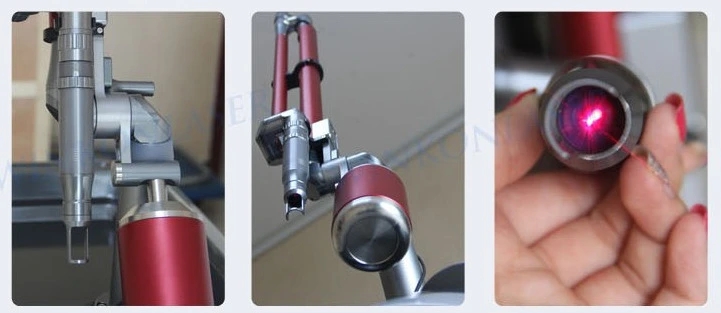 Huafei Picosecond Laser System for Tattoo Eyebrow Removal