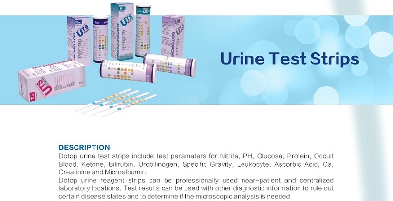 Urine Reagent StripUrine Test Strip