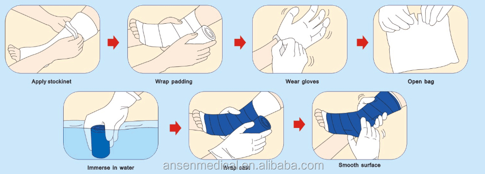 Fiber cast bandage polyester fabric based casting tape leg arm broken cast cover fracture appliance bandage