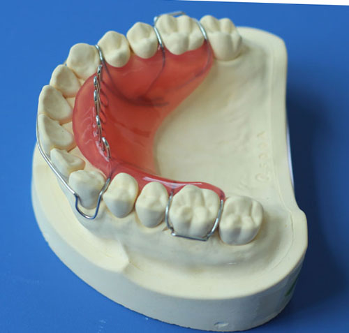 Dental Removable vatallium Metal Framework with partial acrylic resin teethCCP