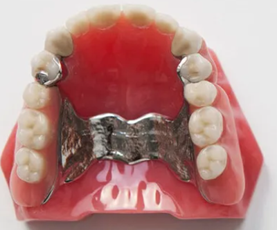 Dental Removable vatallium Metal Framework with partial acrylic resin teethCCP