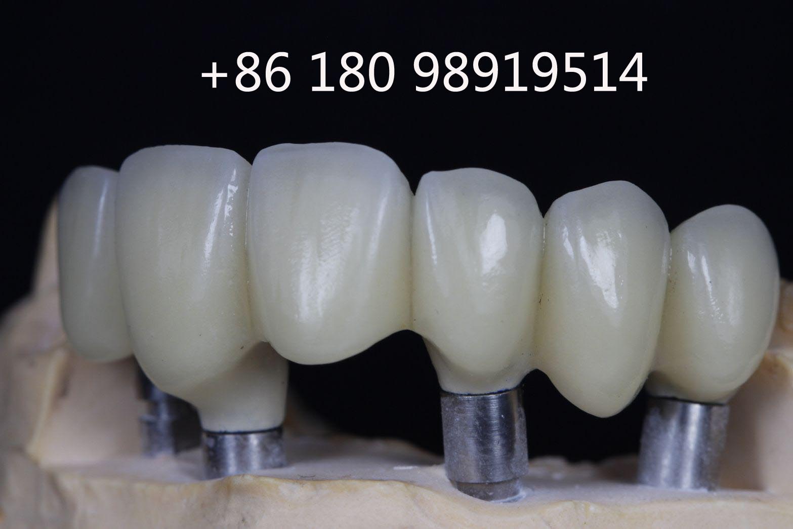 FDA certificated Chinese dental lab looks for USA distributors