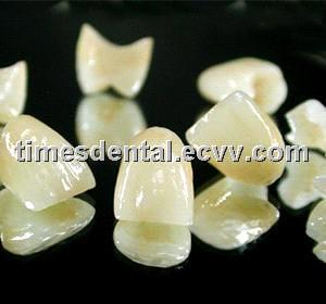 Dental Restoration e.max crown, full ceramic restoration empress crown