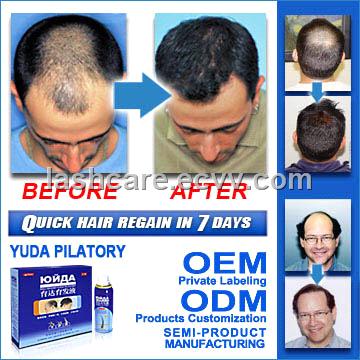 Hair Growth Spray Stop Hair Loss In 7 Days Hair Growth In 15