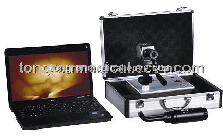 Laptop Type Infrared Mammary Diagnostic Device (TR5000)