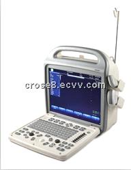 portable color doppler ultrasound diagnostic system