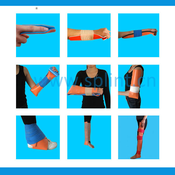 Wholesaleforhandfingerarmlegkneeanklefootfixingsplint