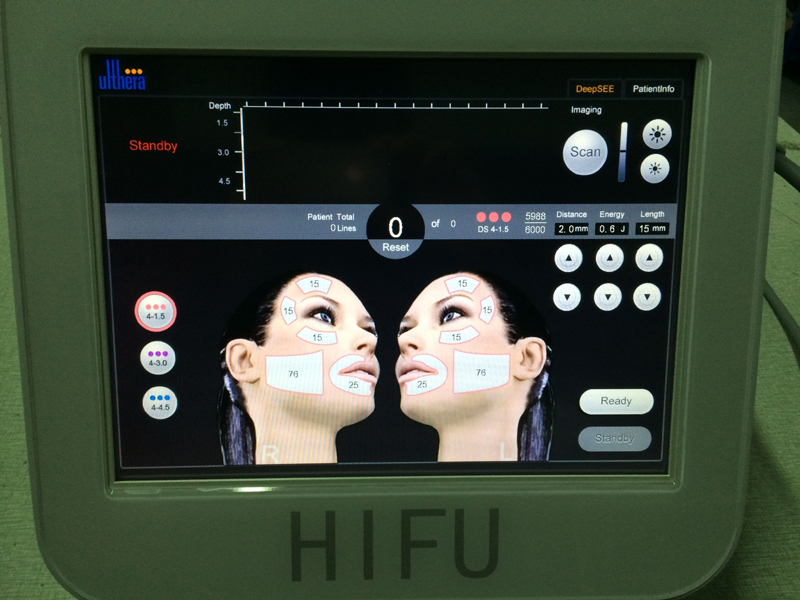 Aesthetics medical care HIFU face lifting skin tightening beauty machine