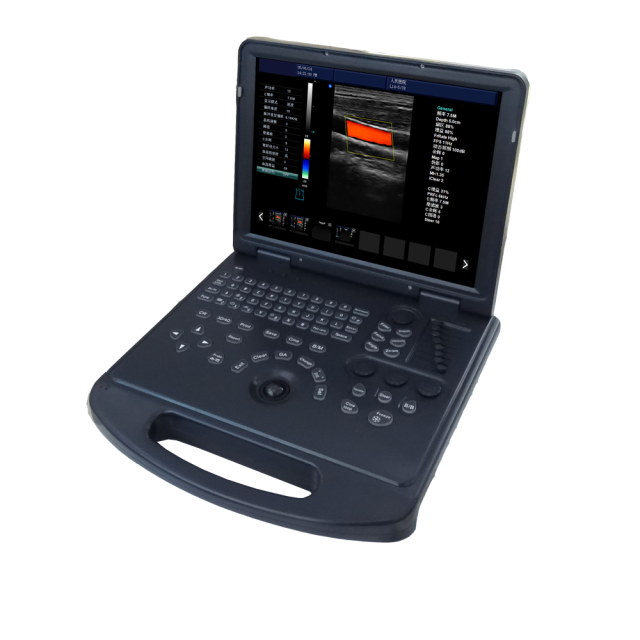 portable doppler ultrasound machine laptop color doppler ultrasound scanner