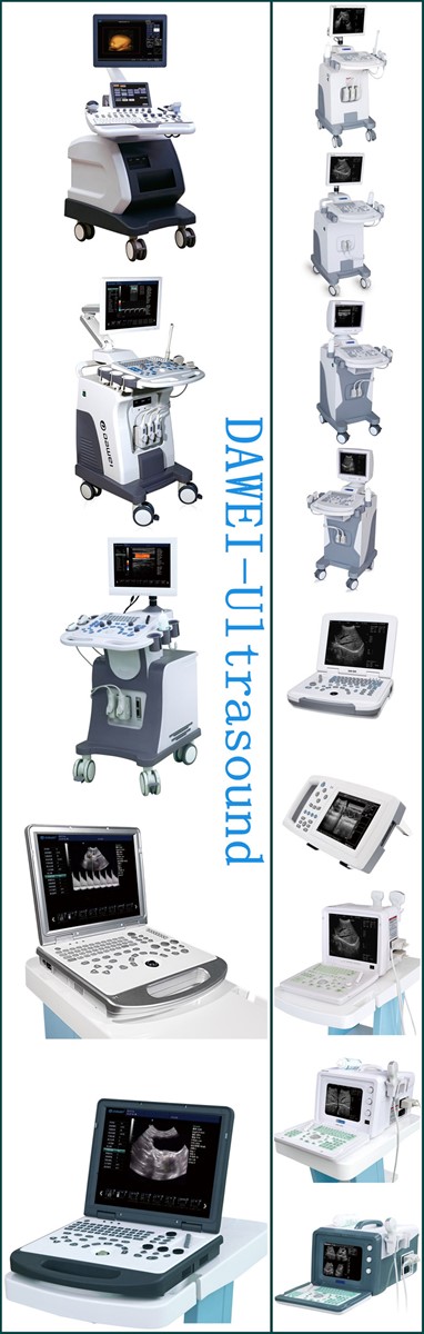 Laptop medical ultrasound mini portable ultrasound machine DW580
