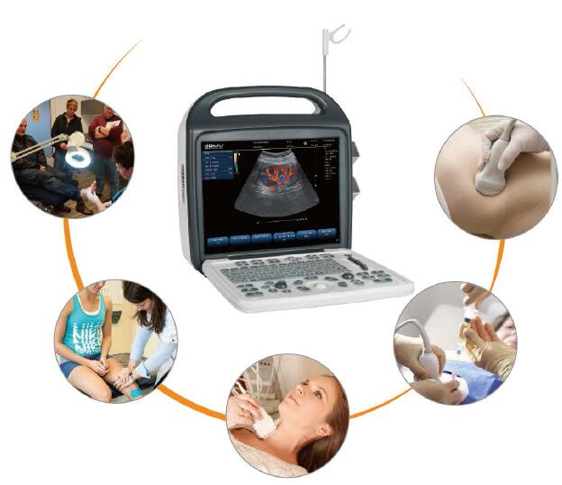 BCU30 Portable Color Doppler Ultrasound System