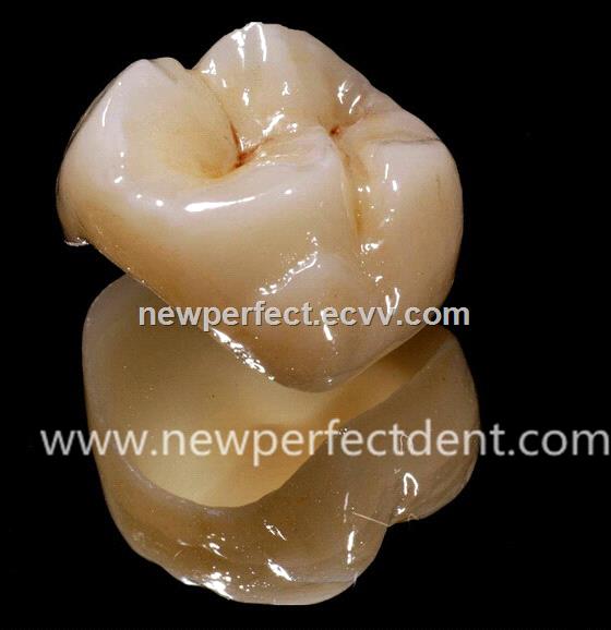 Dental lab Zirconia porcelain denture