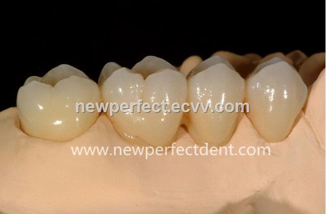 Dental lab Zirconia porcelain denture