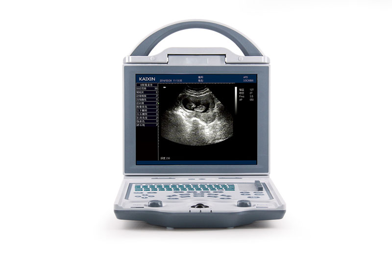 104 Wide Angle Portable Doppler Ultrasound High Resolution Ultrasound Imaging Equipment