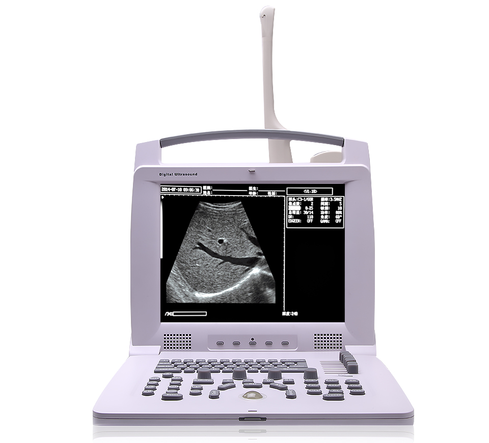 Digital portable Ultrasound Scanner Windows Based 128 Element