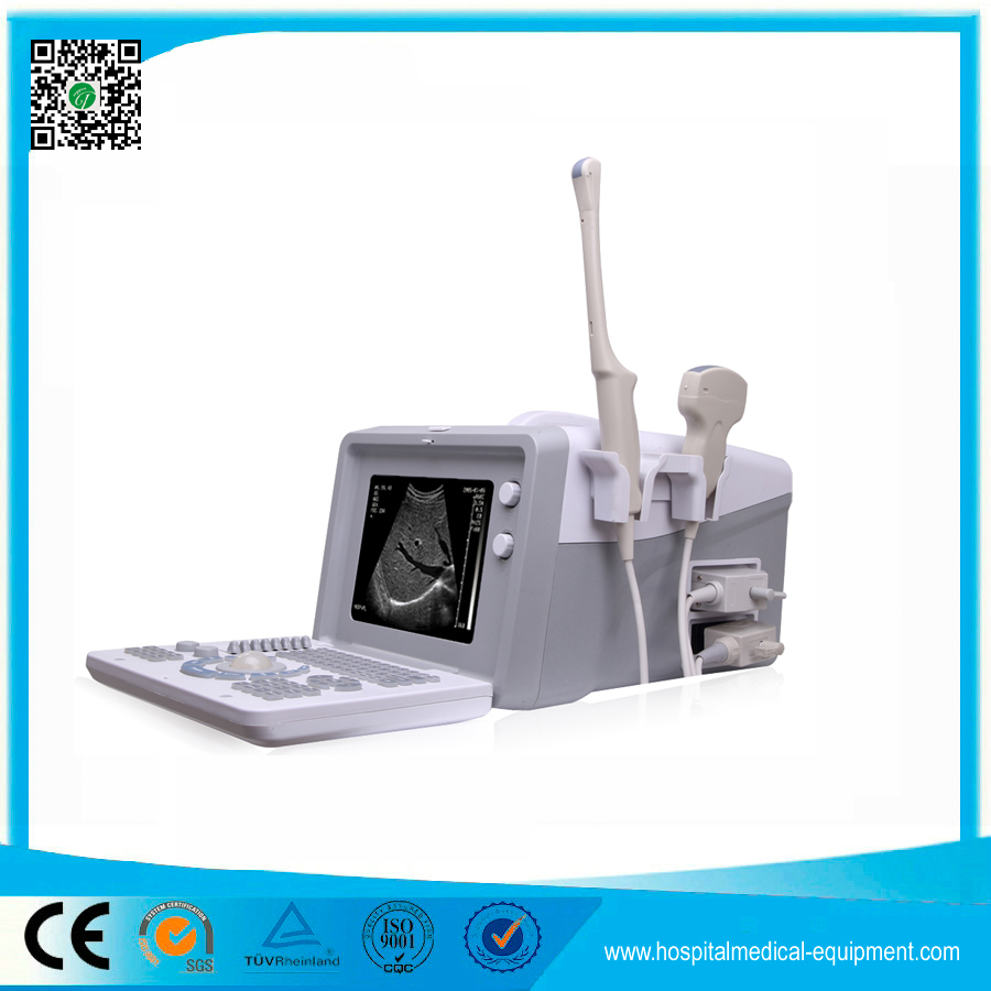 portable Ultrasound Scanner Ultrasound Diagnostic Equipment