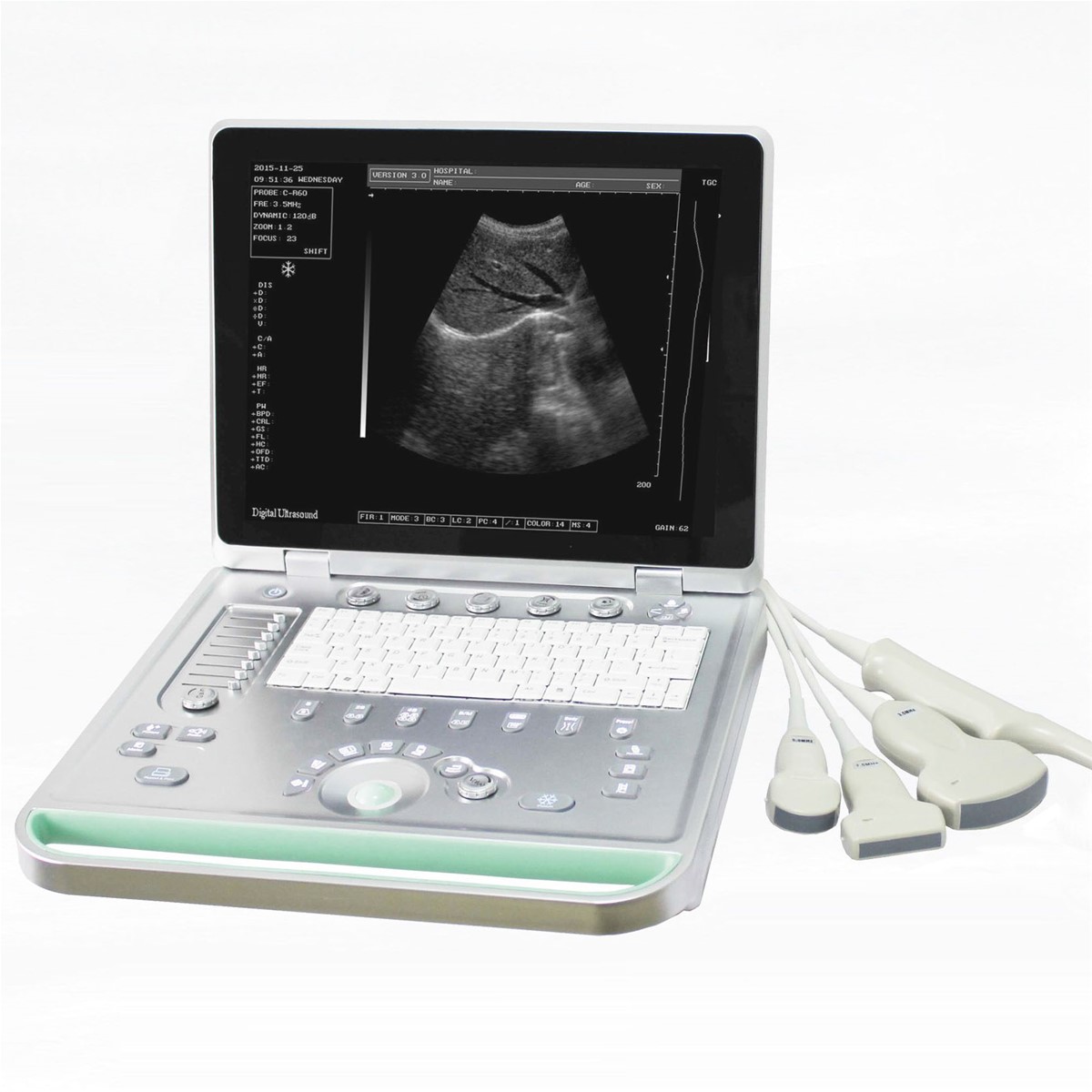 KBW 7 Laptop Ultrasound Scanner Portable BW
