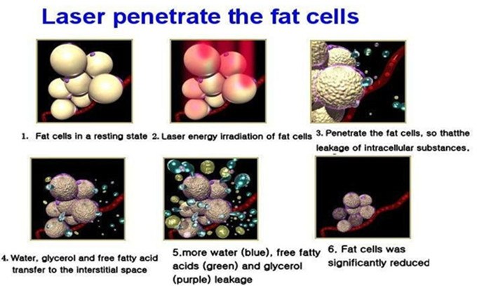 Lipo Laser Slimming Machine