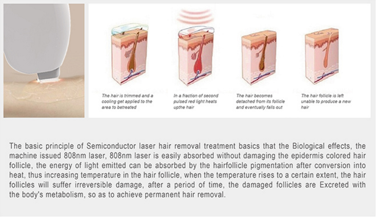 Diode Laser Hair Removal MachineNBWLII