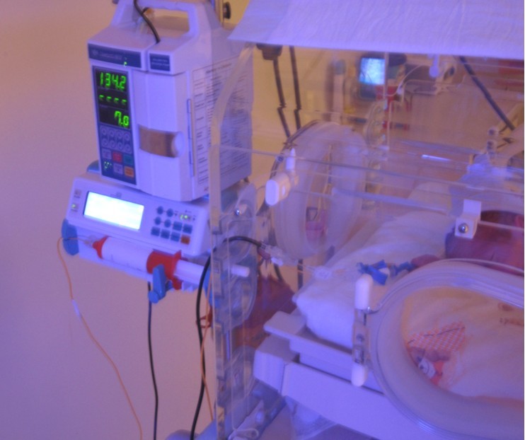 Neonatal Milk Feeding Pump Infant Feeding Pump