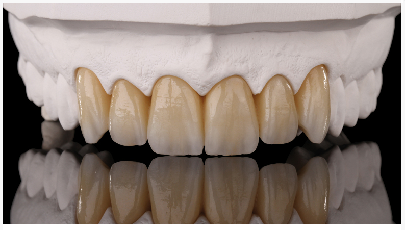 dental zirconia blocks dental implantsdental laboratory material