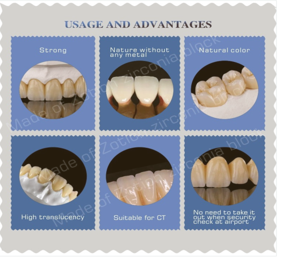Dental implant cadcam system zriconia ceramics block