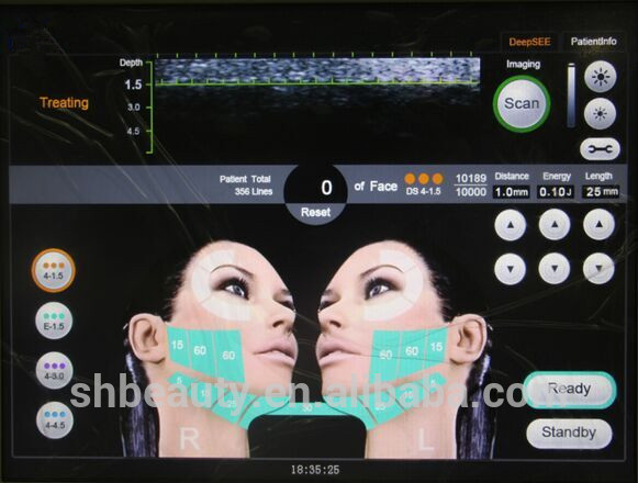 hifu skin lifting Noninvasive ultrasound HIFU system for wrinkle removal and skin lift