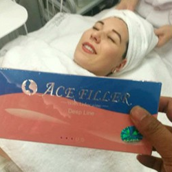 2017 Cosmetic derm line FILLER injectable hyaluronic acid