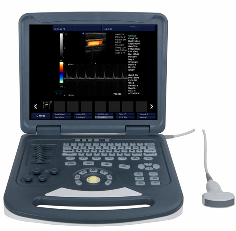 Fulldigital 2D notebook color doppler system with factory price