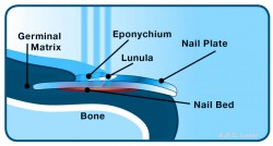 Laser Nail Fungus Onychomycosis Treatment