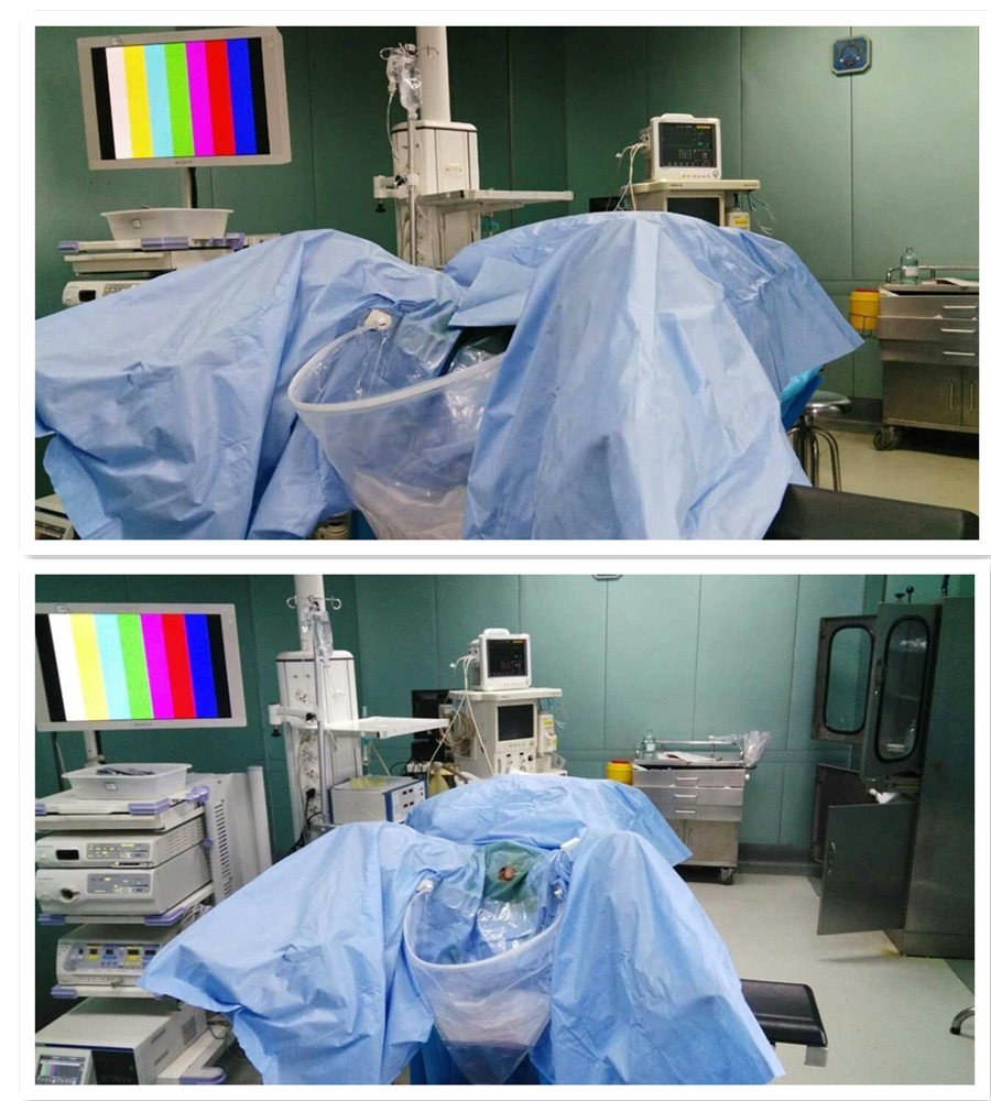 TUR urology surgical drape
