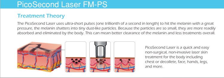 Hottest in Europe market Pico laser tattoo removal machine