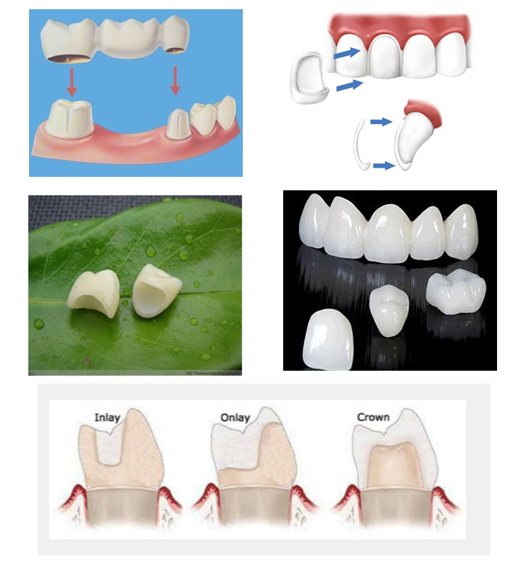 High Quality Dental Consumable Zirconia Block