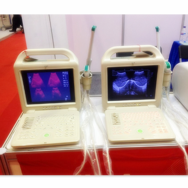 Factoryprice Laptop BW Ultrasound ScannerUSGUltrasonic deviceSonarSonographic equipment CE and ISO