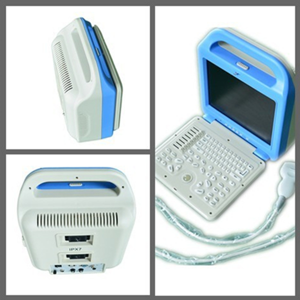 Factoryprice Laptop BW Ultrasound ScannerUSGUltrasonic deviceSonarSonographic equipment CE and ISO