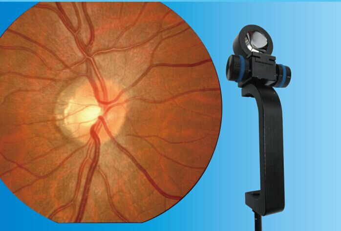 Slit Lamp Retinal View System for Ophthalmology
