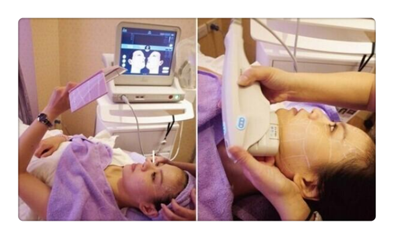 Professional Skin Tightening Facial Treatment Hifu Device
