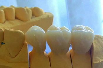 Horno de porcelana Dental zirconia cadcam price