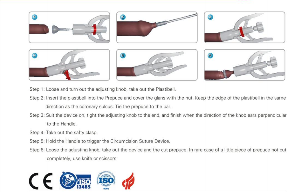 Disposable Circumcision Suture Device