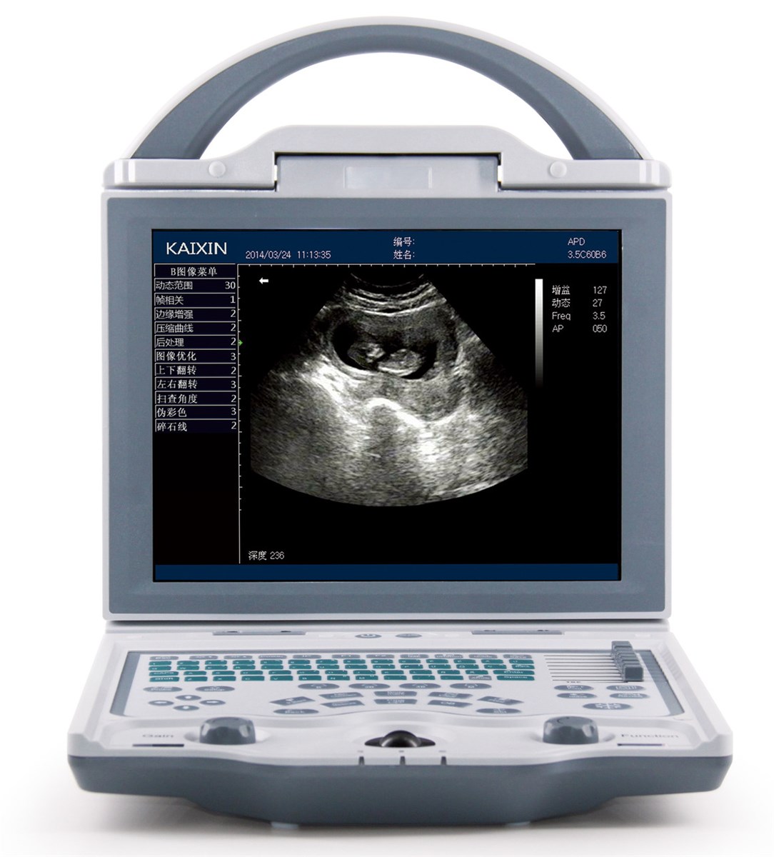 Medical Hospital Equipmentportable BW Ultrasound Scanner for Human KX5600