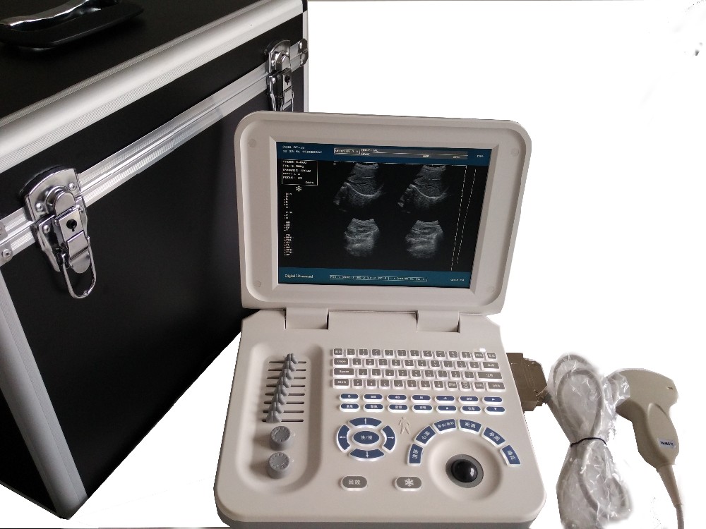 Pl3018 Digital Laptop Ultrasound Scanner