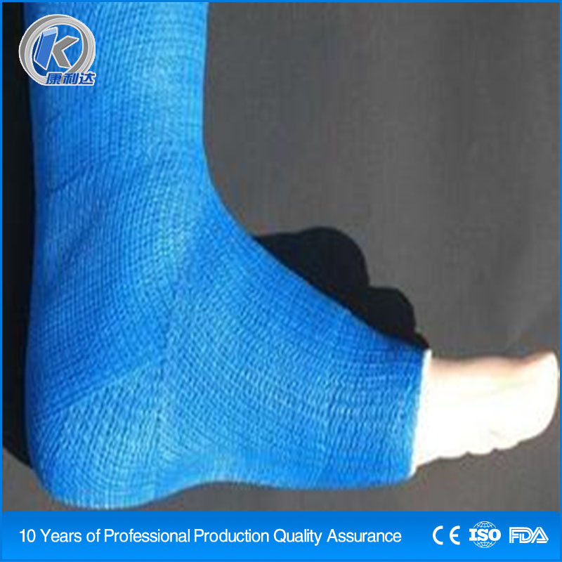 Factory Supply Medical Cast Bandage High Quality Colored Orthopedic Fiberglass Casting Tape