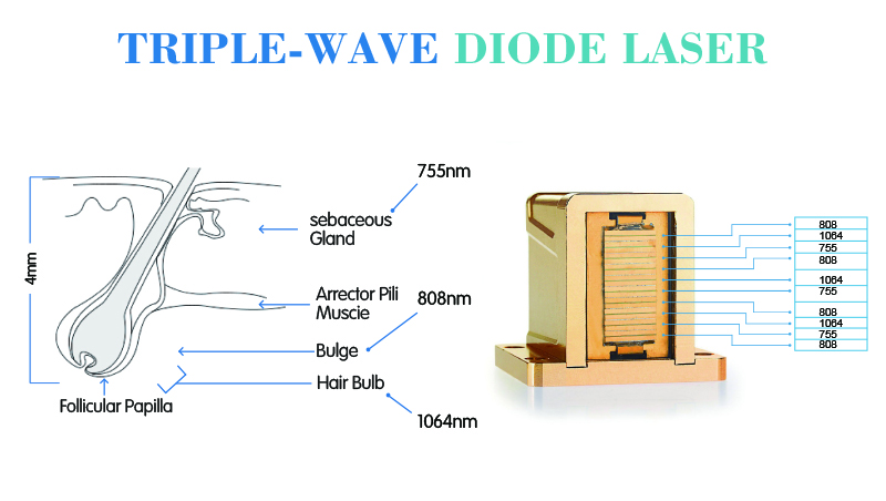 2018 Newest model CE approval Triple Wave 1064nm 755nm 810nm diode laser for hair removal
